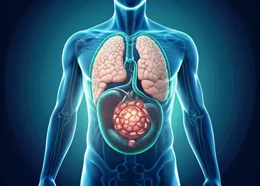 retroperitoneal-tumor